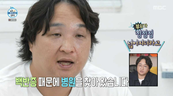 ‘나 혼자 산다’ 구성환 백반증 방송에 성형외과 해명 “전문 치료 진행 안 해”