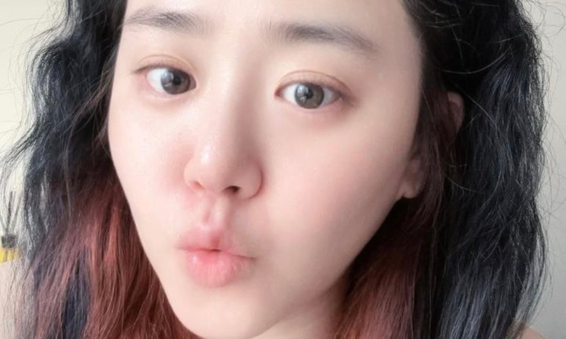 '희소병 완치' 문근영, 오랜만에 근황 공개